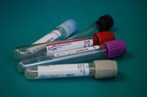 drug test samples