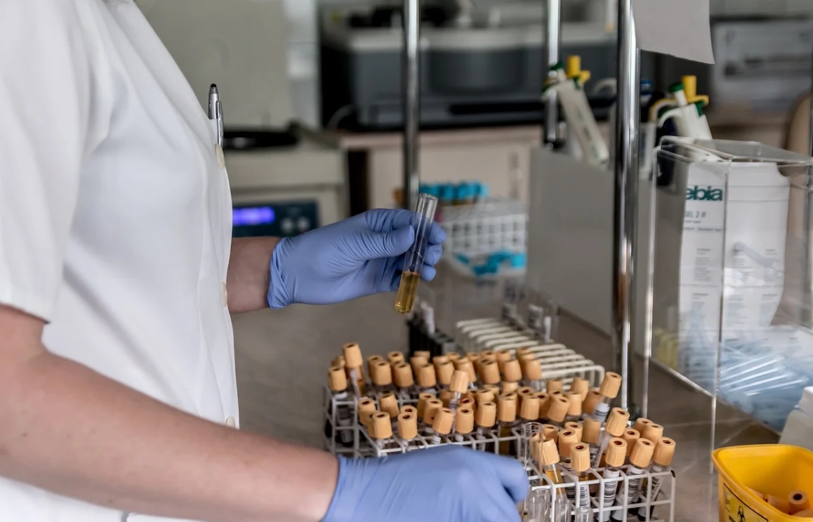 urine test - using synthetic urine